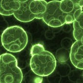 NEW: Legionella Outbreak in Washington Heights, New York